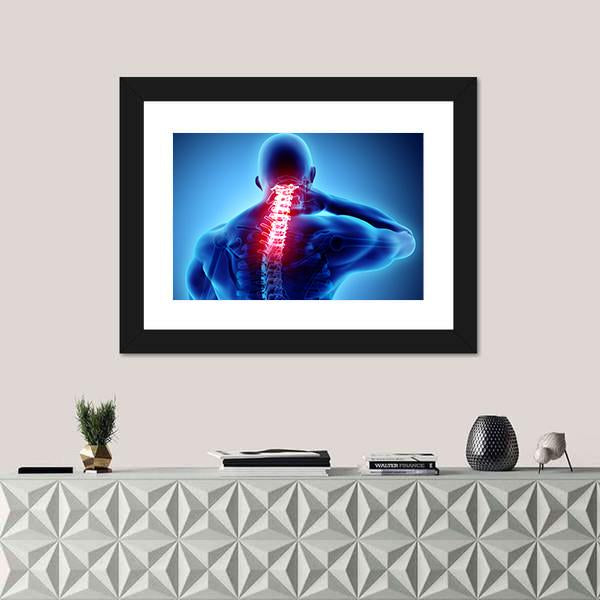 Painful Neck With Cervical Spine Skeleton X-Ray Canvas Wall Art-1 Piece-Framed Print-20" x 16"-Tiaracle
