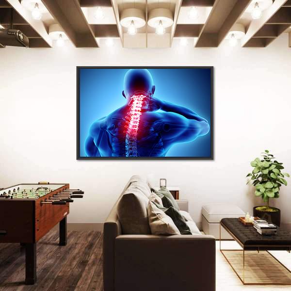 Painful Neck With Cervical Spine Skeleton X-Ray Canvas Wall Art-3 Horizontal-Gallery Wrap-25" x 16"-Tiaracle