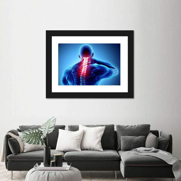 Painful Neck With Cervical Spine Skeleton X-Ray Canvas Wall Art-3 Horizontal-Gallery Wrap-25" x 16"-Tiaracle