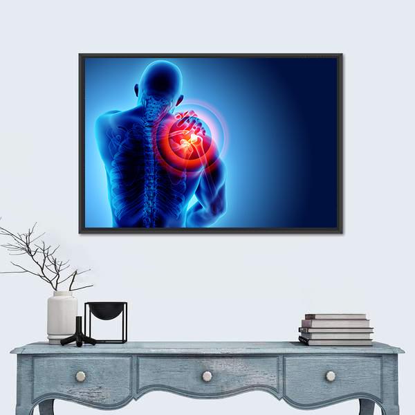 Shoulder Painful Skeleton X-Ray Canvas Wall Art-1 Piece-Floating Frame-24" x 16"-Tiaracle