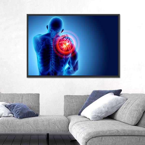 Shoulder Painful Skeleton X-Ray Canvas Wall Art-3 Horizontal-Gallery Wrap-25" x 16"-Tiaracle
