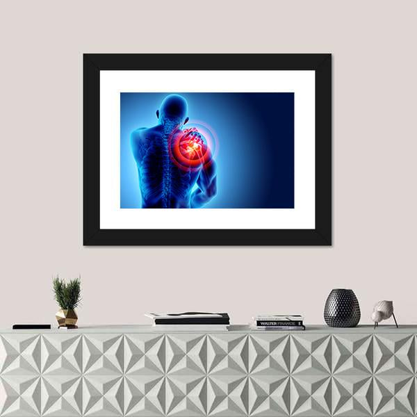 Shoulder Painful Skeleton X-Ray Canvas Wall Art-5 Horizontal-Gallery Wrap-22" x 12"-Tiaracle