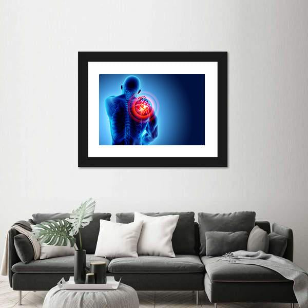Shoulder Painful Skeleton X-Ray Canvas Wall Art-3 Horizontal-Gallery Wrap-25" x 16"-Tiaracle