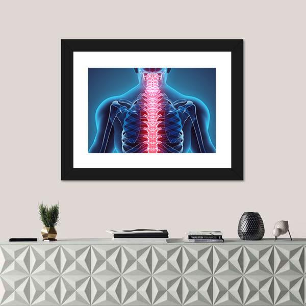 Spine Illustration Canvas Wall Art-1 Piece-Framed Print-20" x 16"-Tiaracle