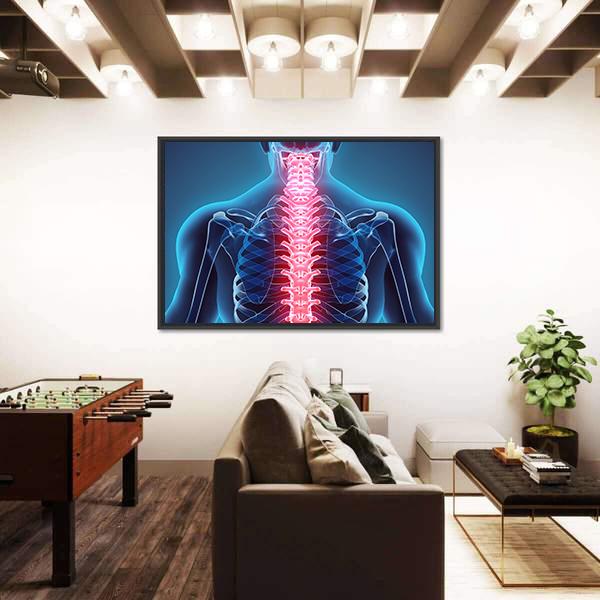 Spine Illustration Canvas Wall Art-5 Horizontal-Gallery Wrap-22" x 12"-Tiaracle