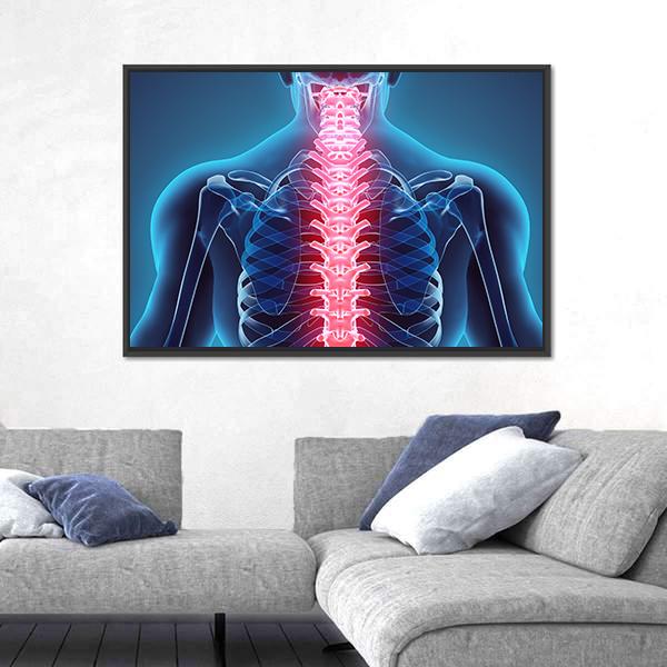 Spine Illustration Canvas Wall Art-5 Horizontal-Gallery Wrap-22" x 12"-Tiaracle