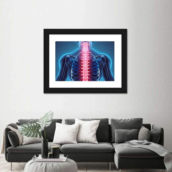 Spine Illustration Canvas Wall Art-5 Horizontal-Gallery Wrap-22" x 12"-Tiaracle