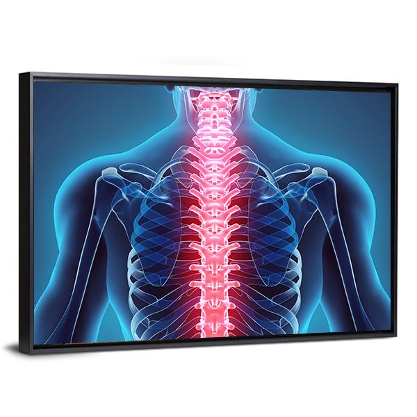 Spine Illustration Canvas Wall Art-5 Horizontal-Gallery Wrap-22" x 12"-Tiaracle