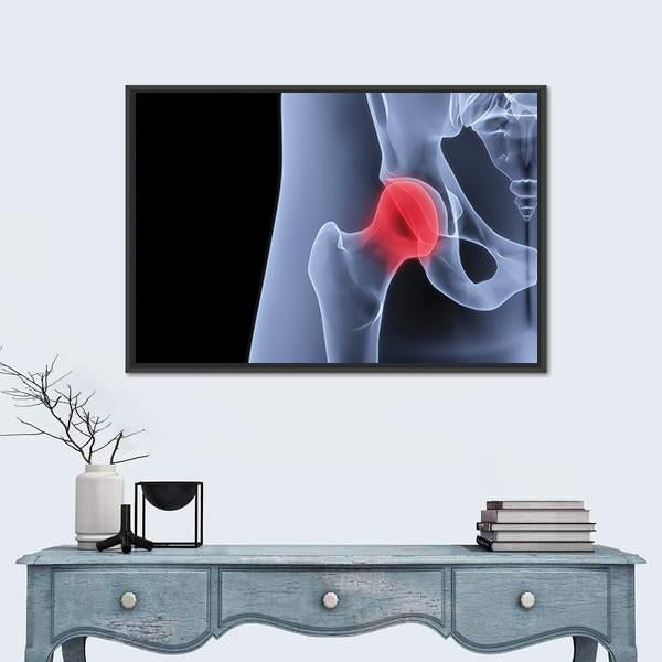 X-Rays Of Pelvis Canvas Wall Art-1 Piece-Floating Frame-24" x 16"-Tiaracle