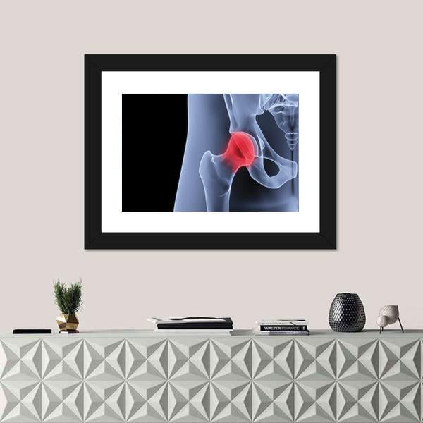 X-Rays Of Pelvis Canvas Wall Art-1 Piece-Framed Print-20" x 16"-Tiaracle