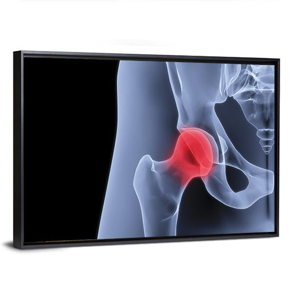 X-Rays Of Pelvis Canvas Wall Art-3 Horizontal-Gallery Wrap-25" x 16"-Tiaracle