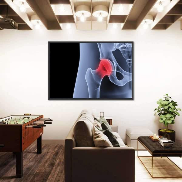 X-Rays Of Pelvis Canvas Wall Art-3 Horizontal-Gallery Wrap-25" x 16"-Tiaracle