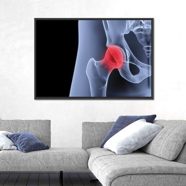 X-Rays Of Pelvis Canvas Wall Art-3 Horizontal-Gallery Wrap-25" x 16"-Tiaracle