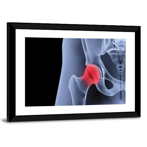 X-Rays Of Pelvis Canvas Wall Art-3 Horizontal-Gallery Wrap-25" x 16"-Tiaracle