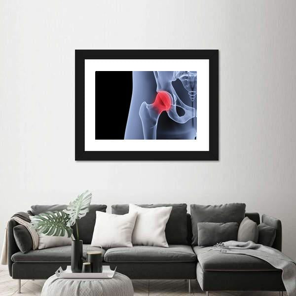 X-Rays Of Pelvis Canvas Wall Art-3 Horizontal-Gallery Wrap-25" x 16"-Tiaracle