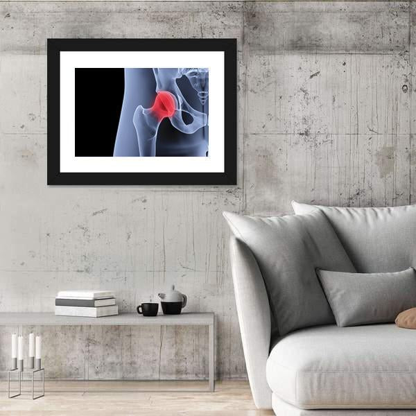 X-Rays Of Pelvis Canvas Wall Art-3 Horizontal-Gallery Wrap-25" x 16"-Tiaracle