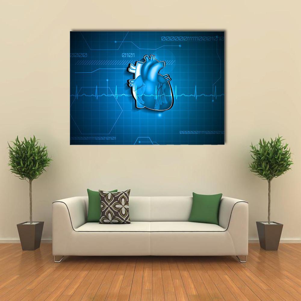 Abstract Of Cardiology Canvas Wall Art-4 Horizontal-Gallery Wrap-34" x 24"-Tiaracle