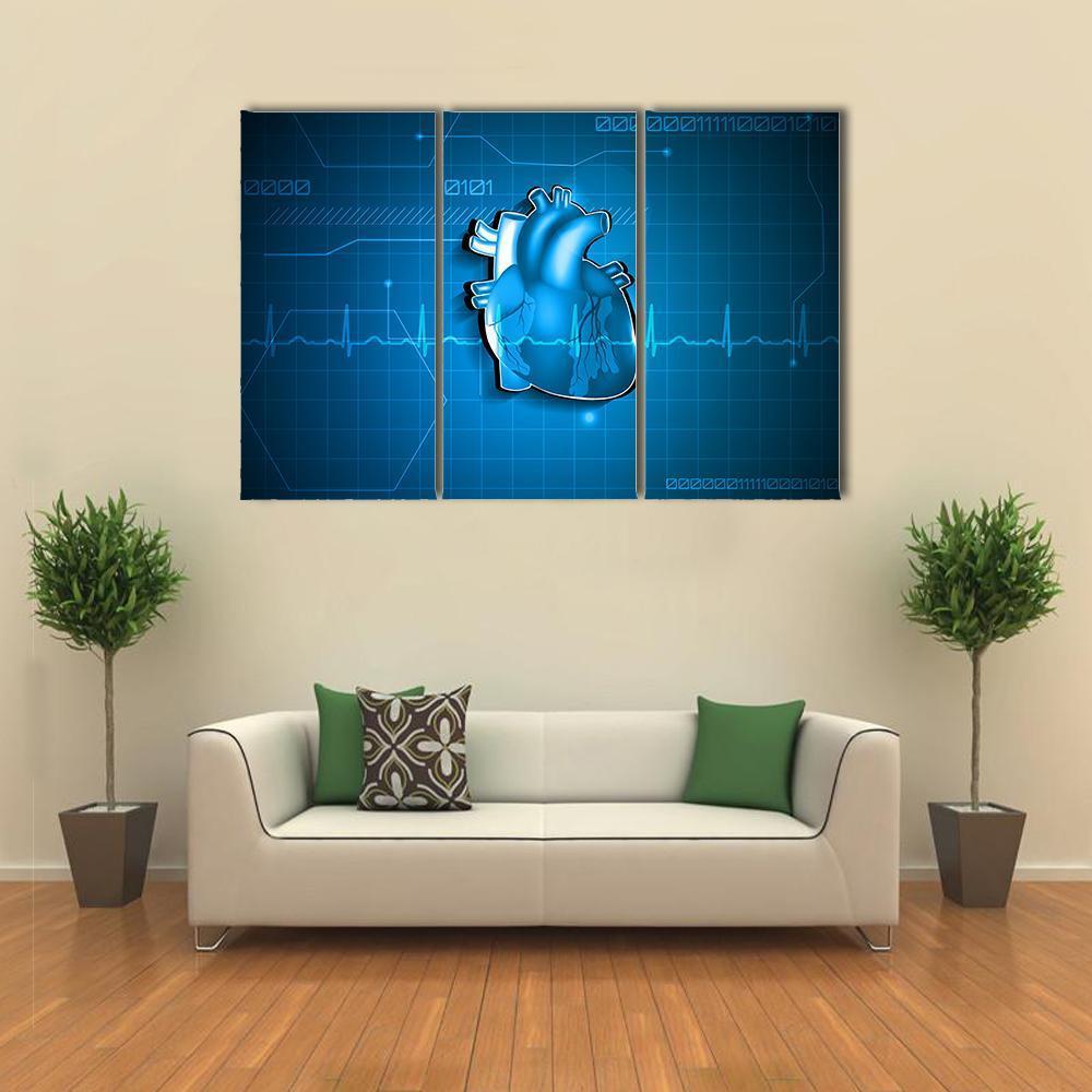 Abstract Of Cardiology Canvas Wall Art-3 Horizontal-Gallery Wrap-37" x 24"-Tiaracle