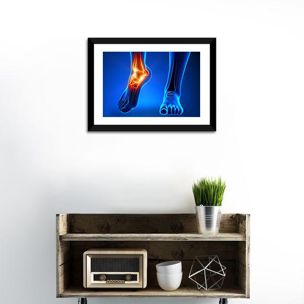 Ankle Pain Detail Canvas Wall Art-1 Piece-Framed Print-20" x 16"-Tiaracle