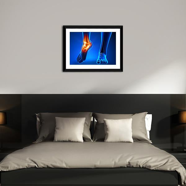 Ankle Pain Detail Canvas Wall Art-3 Horizontal-Gallery Wrap-25" x 16"-Tiaracle