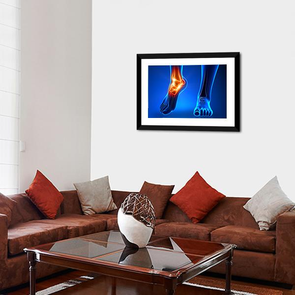 Ankle Pain Detail Canvas Wall Art-3 Horizontal-Gallery Wrap-25" x 16"-Tiaracle