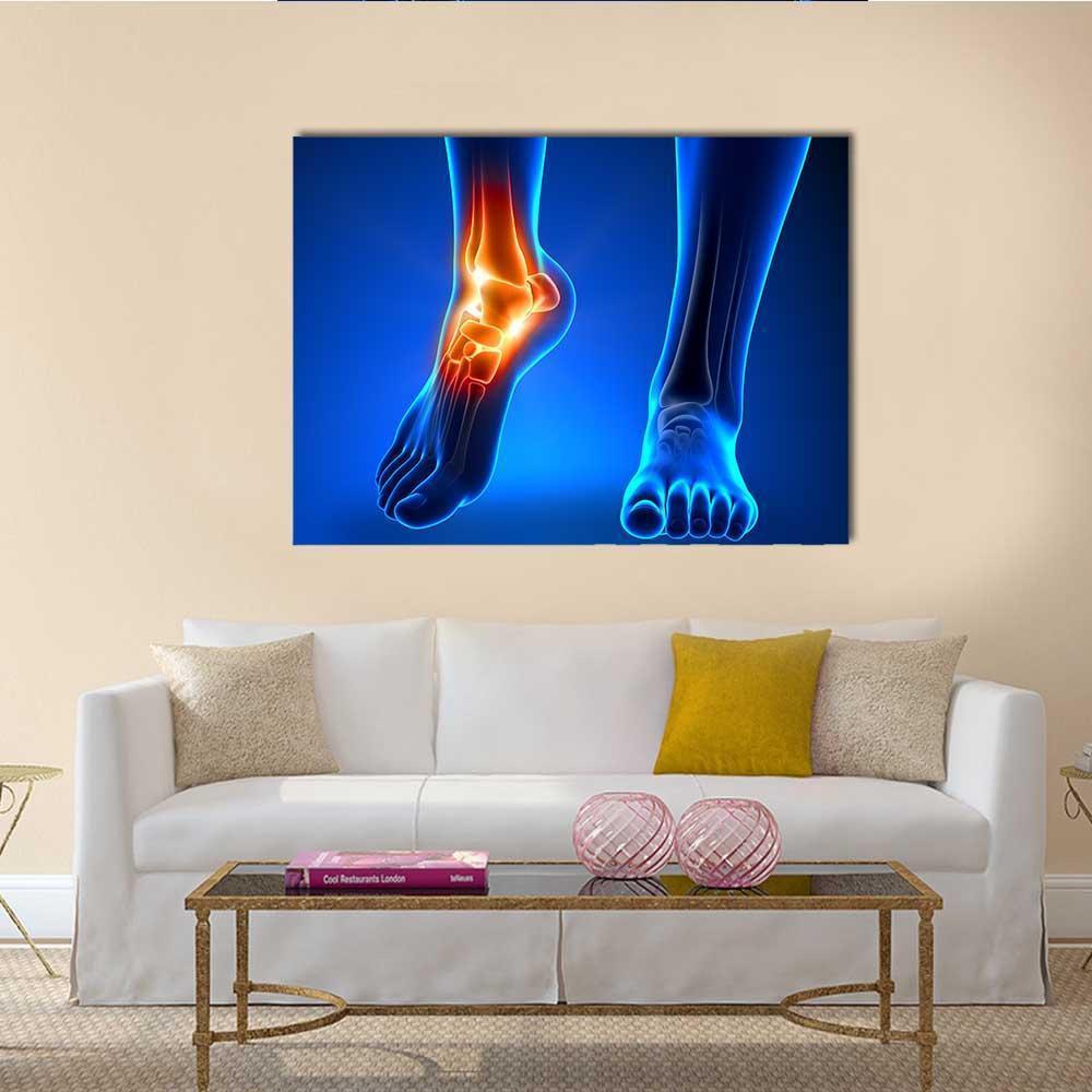 Ankle Pain Detail Canvas Wall Art-4 Square-Gallery Wrap-17" x 17"-Tiaracle