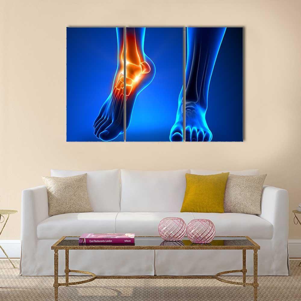 Ankle Pain Detail Canvas Wall Art-3 Horizontal-Gallery Wrap-37" x 24"-Tiaracle