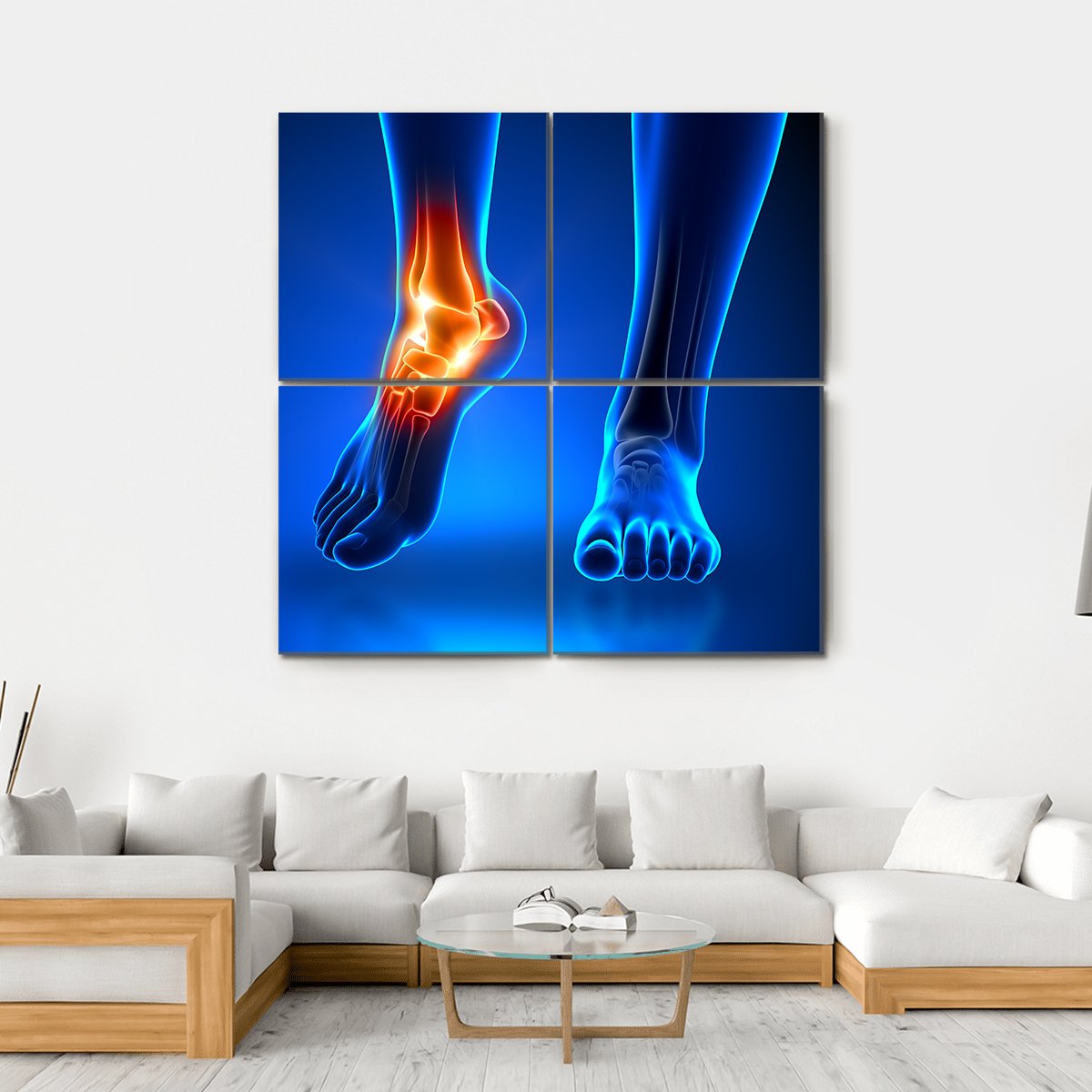 Ankle Pain Detail Canvas Wall Art-4 Square-Gallery Wrap-17" x 17"-Tiaracle