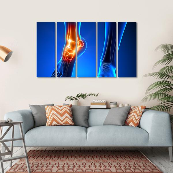 Ankle Pain Detail Canvas Wall Art-5 Horizontal-Gallery Wrap-22" x 12"-Tiaracle