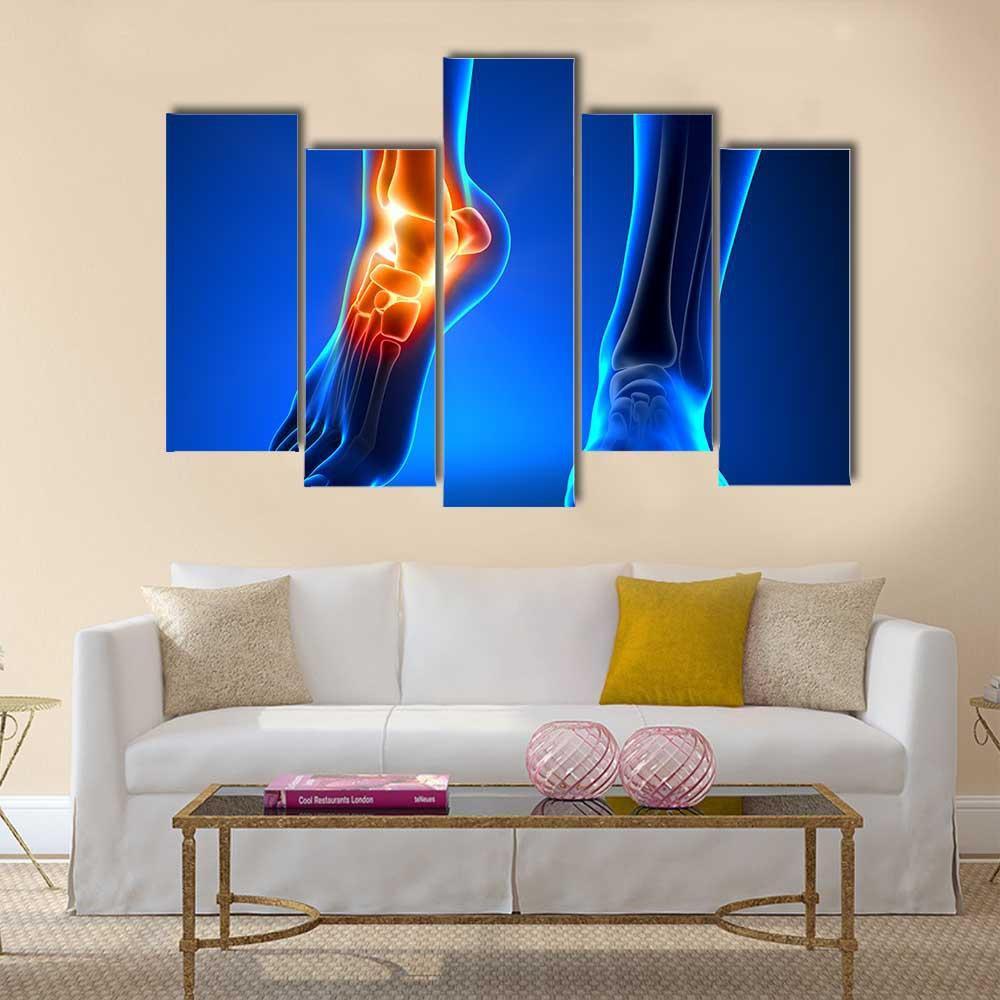 Ankle Pain Detail Canvas Wall Art-1 Piece-Gallery Wrap-48" x 32"-Tiaracle