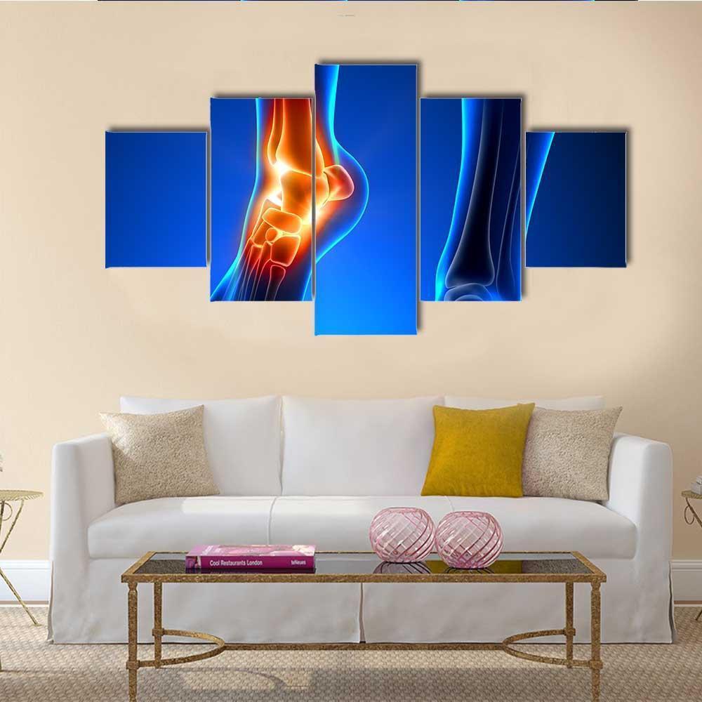 Ankle Pain Detail Canvas Wall Art-5 Star-Gallery Wrap-62" x 32"-Tiaracle