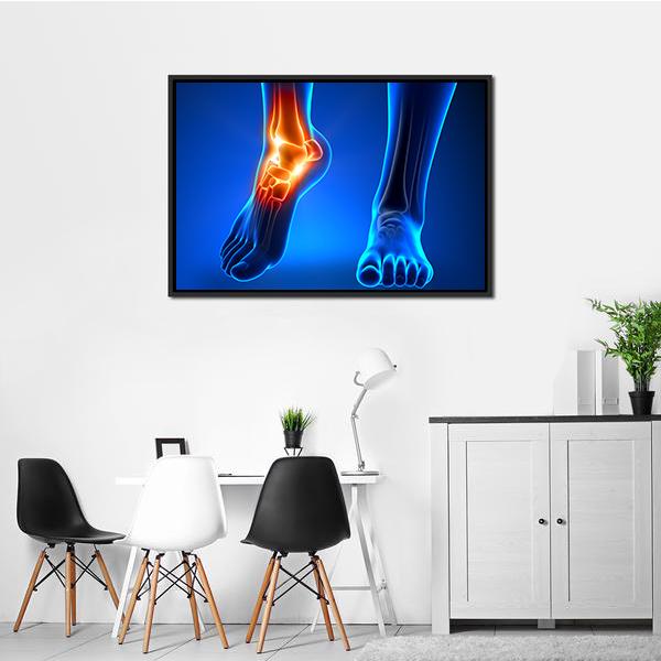 Ankle Pain Detail Canvas Wall Art-1 Piece-Floating Frame-24" x 16"-Tiaracle