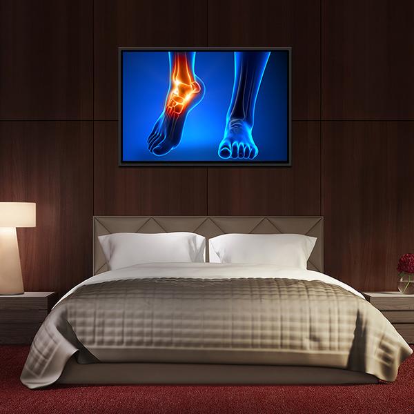 Ankle Pain Detail Canvas Wall Art-5 Horizontal-Gallery Wrap-22" x 12"-Tiaracle