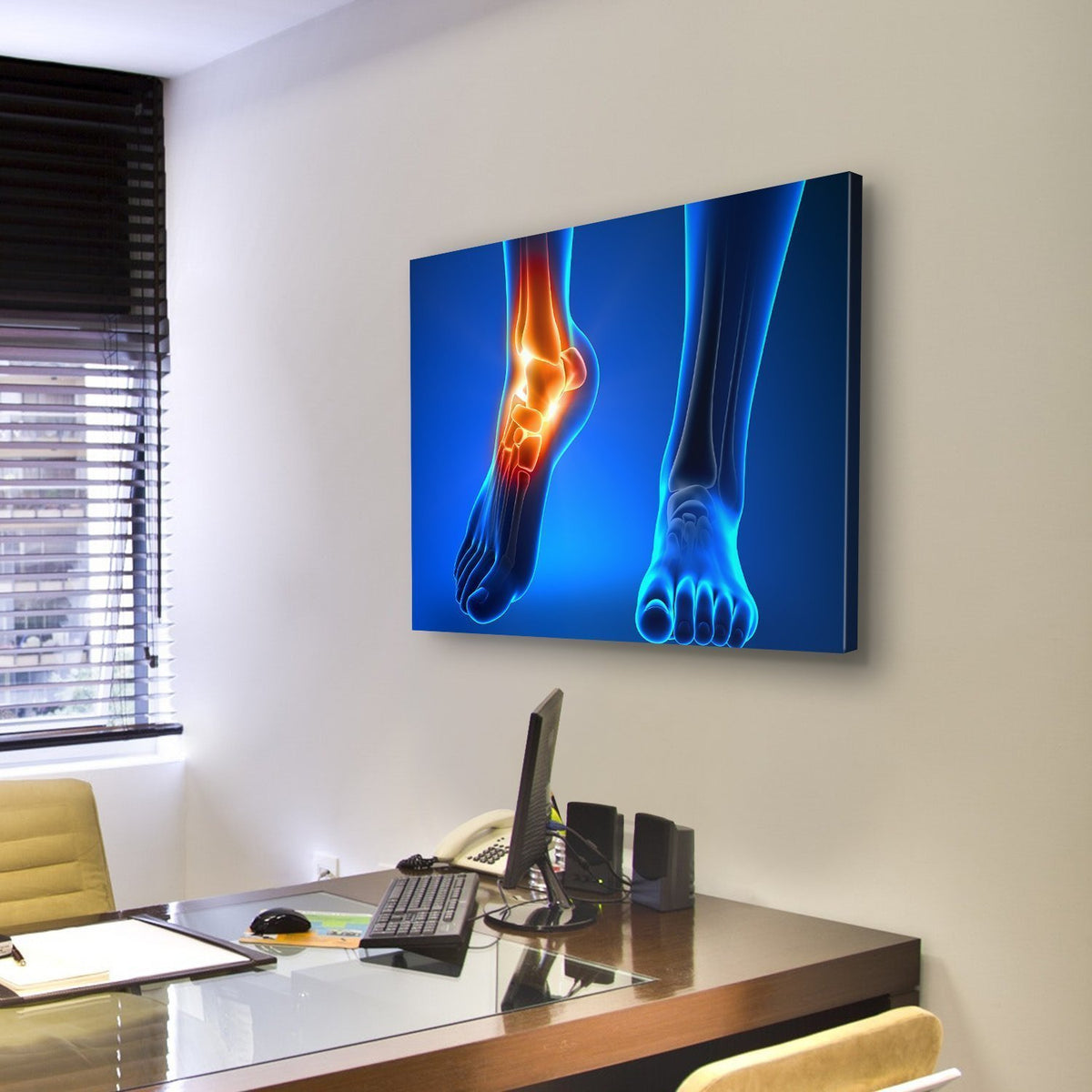 Ankle Pain Detail Canvas Wall Art-3 Horizontal-Gallery Wrap-25" x 16"-Tiaracle