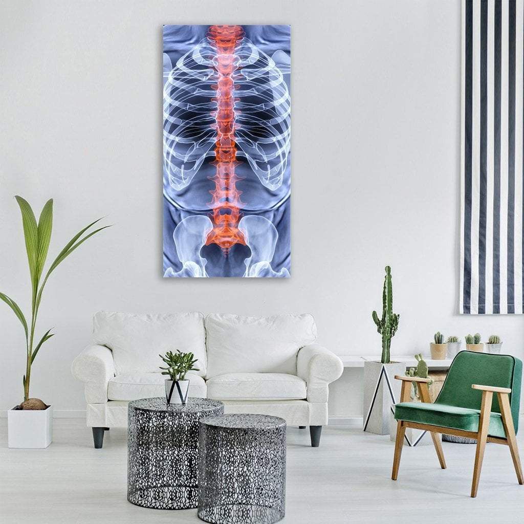 X-Ray Of Men Torso Vertical Canvas Wall Art-1 Vertical-Gallery Wrap-12" x 24"-Tiaracle
