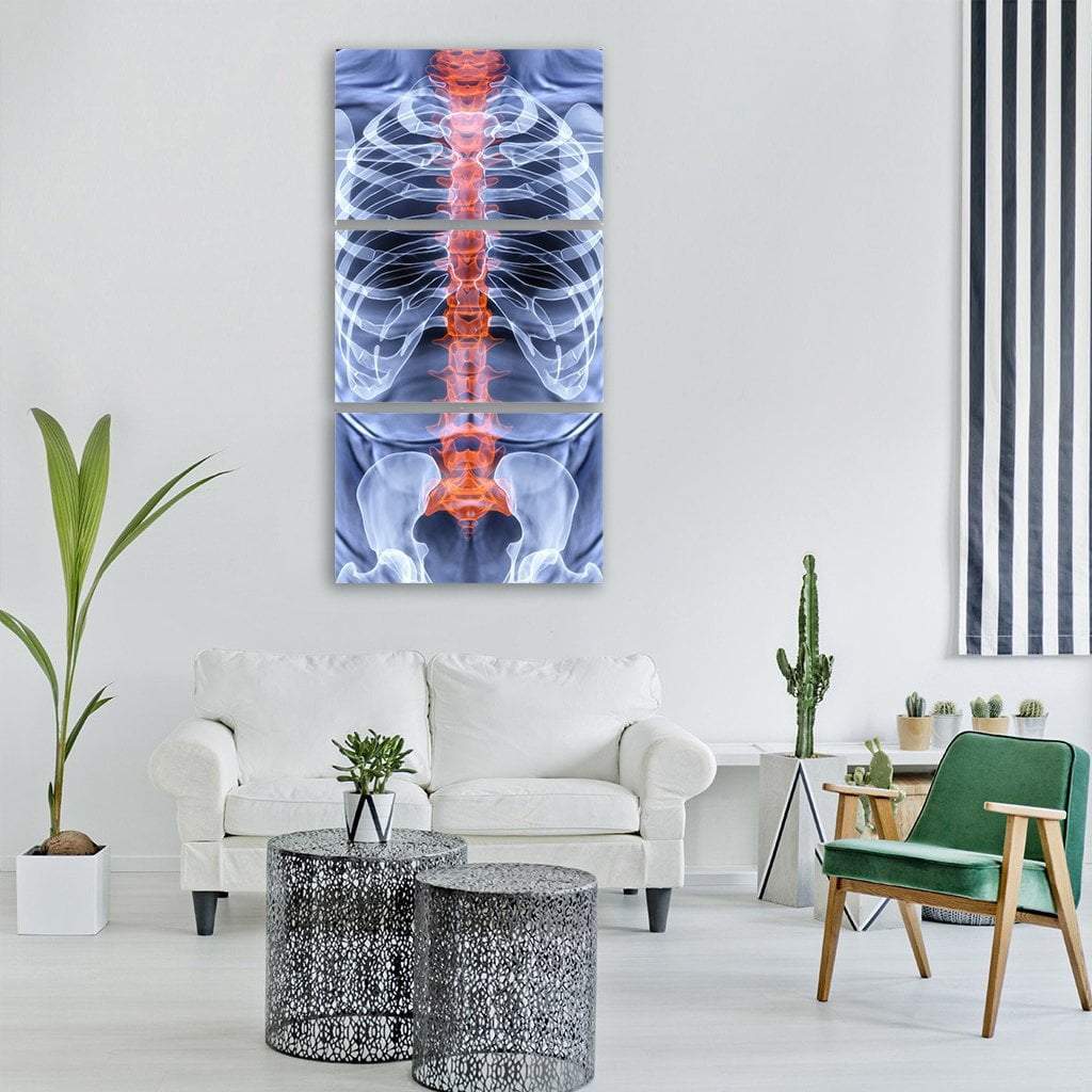 X-Ray Of Men Torso Vertical Canvas Wall Art-3 Vertical-Gallery Wrap-12" x 25"-Tiaracle