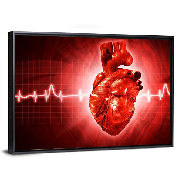 ECG Of Human Heart Canvas Wall Art-5 Horizontal-Gallery Wrap-22" x 12"-Tiaracle