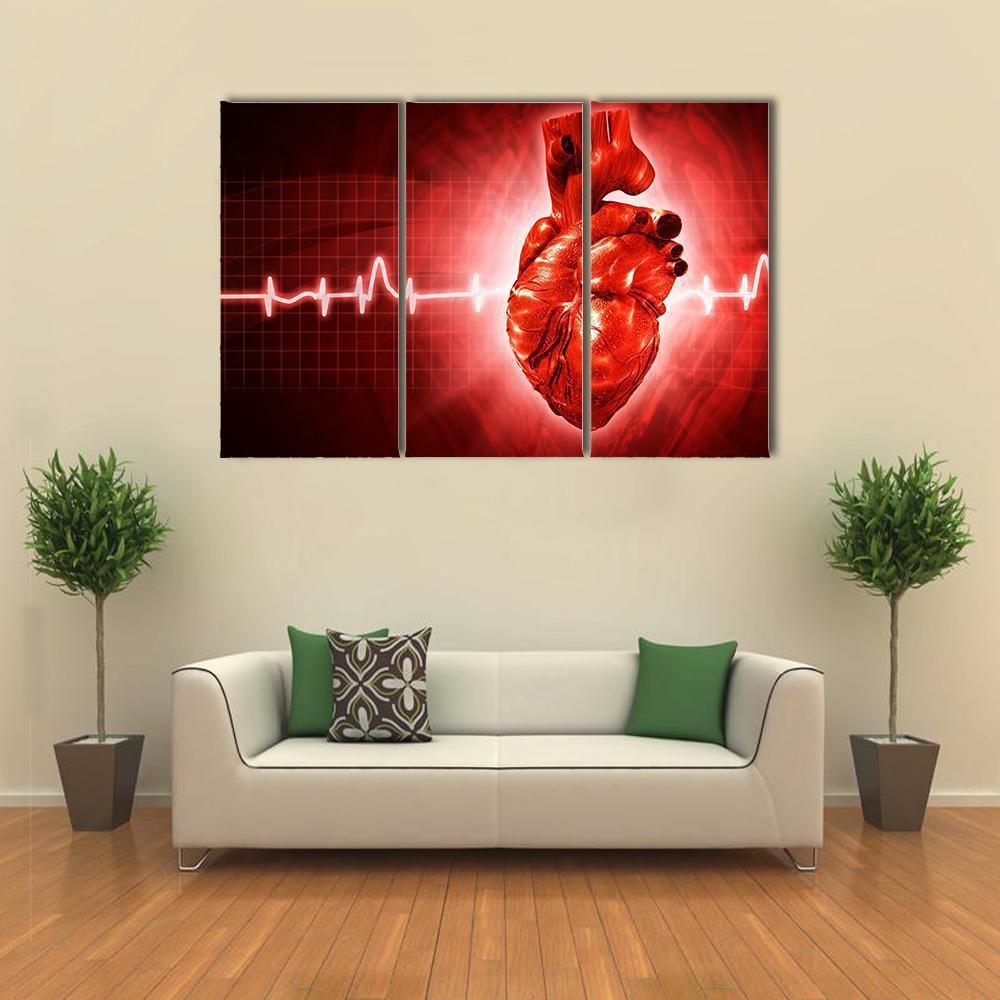 ECG Of Human Heart Canvas Wall Art-3 Horizontal-Gallery Wrap-37" x 24"-Tiaracle