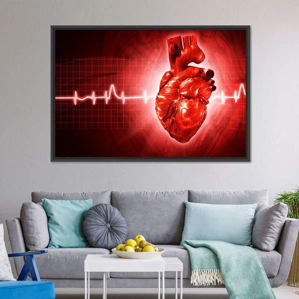 ECG Of Human Heart Canvas Wall Art-3 Horizontal-Gallery Wrap-25" x 16"-Tiaracle