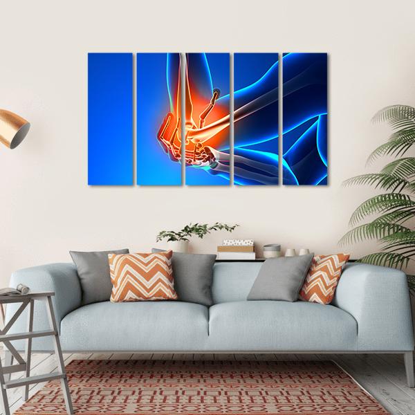 Elbow Pain Illustration Canvas Wall Art-5 Horizontal-Gallery Wrap-22" x 12"-Tiaracle