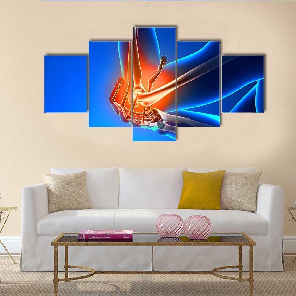 Elbow Pain Illustration Canvas Wall Art-5 Star-Gallery Wrap-62" x 32"-Tiaracle