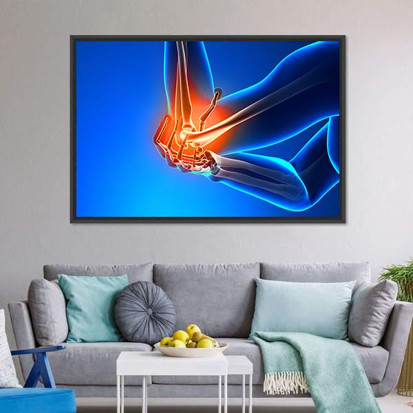 Elbow Pain Illustration Vertical Canvas Wall Art-3 Vertical-Gallery Wrap-12" x 25"-Tiaracle