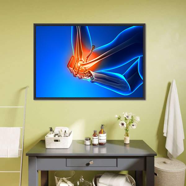 Elbow Pain Illustration Vertical Canvas Wall Art-3 Vertical-Gallery Wrap-12" x 25"-Tiaracle