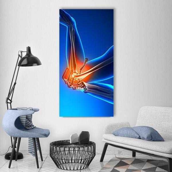 Elbow Pain Illustration Vertical Canvas Wall Art-1 Vertical-Gallery Wrap-12&quot; x 24&quot;-Tiaracle