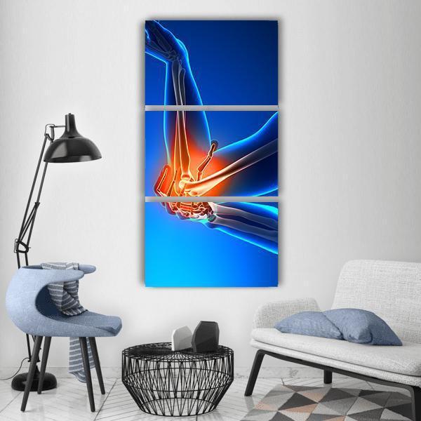 Elbow Pain Illustration Vertical Canvas Wall Art-3 Vertical-Gallery Wrap-12" x 25"-Tiaracle