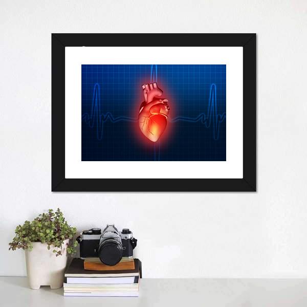 Heart Disease Illustration Canvas Wall Art-5 Horizontal-Gallery Wrap-22" x 12"-Tiaracle