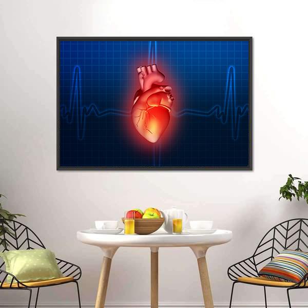 Heart Disease Illustration Canvas Wall Art-5 Horizontal-Gallery Wrap-22" x 12"-Tiaracle