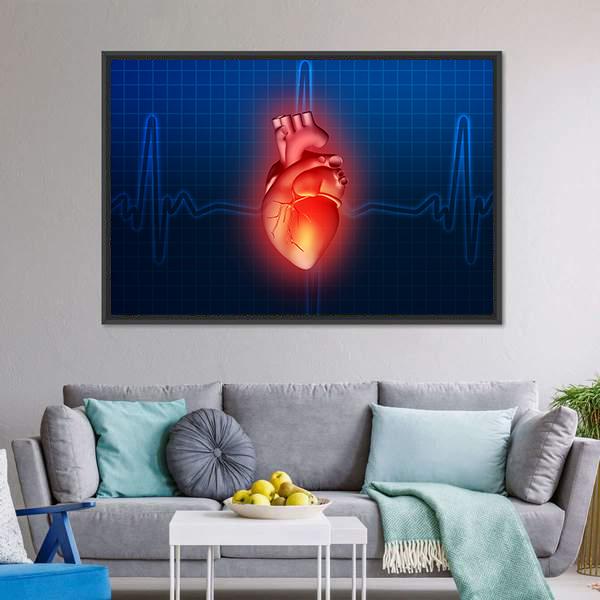 Heart Disease Illustration Canvas Wall Art-1 Piece-Floating Frame-24" x 16"-Tiaracle