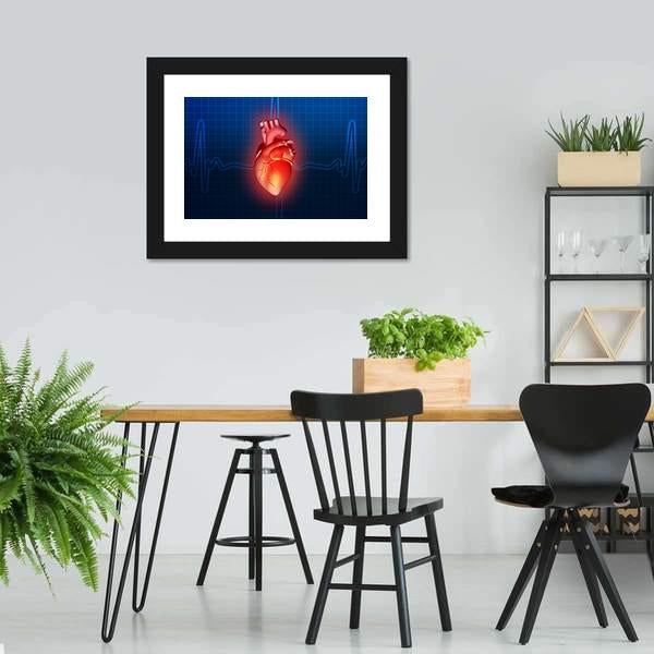 Heart Disease Illustration Canvas Wall Art-3 Horizontal-Gallery Wrap-25" x 16"-Tiaracle