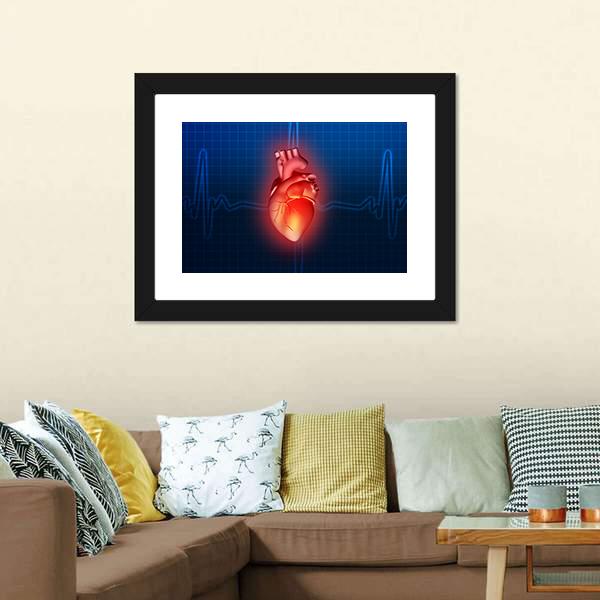 Heart Disease Illustration Canvas Wall Art-1 Piece-Framed Print-20" x 16"-Tiaracle